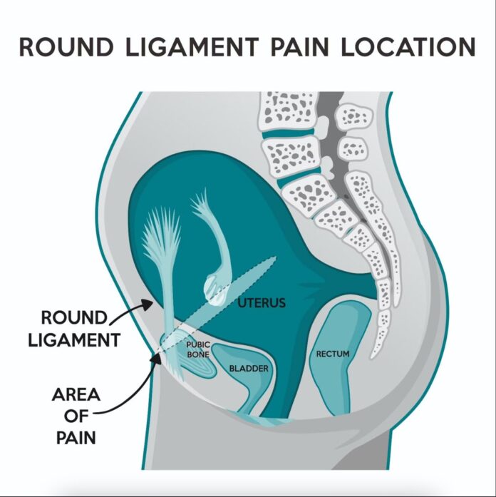 round-ligament-pain-causes-symptoms-diagnosis-treatment-more